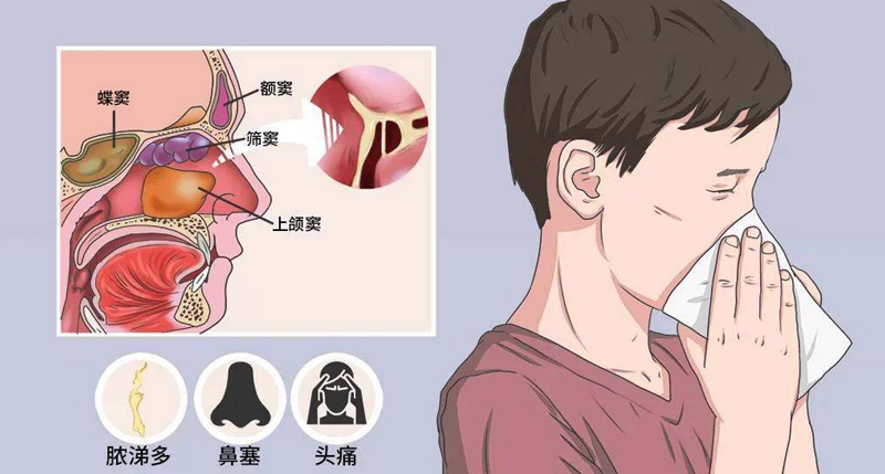 天冷鼻敏感，摆脱鼻塞流涕有妙招